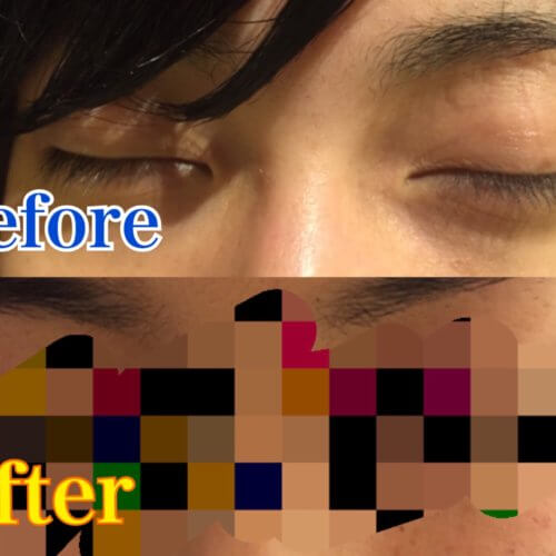 【芸能人御用達!?】男の僕が人生初のマツエクをしてみた!