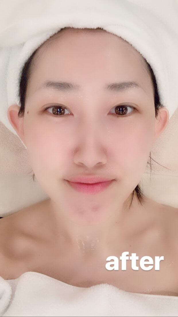 必見!メイクの黒木が見つけた最強アイケアはこれ!
